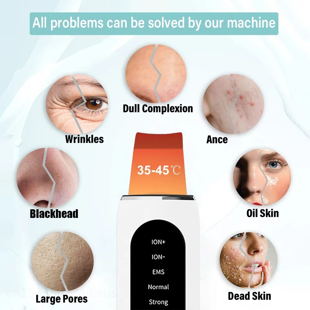 Depurador ultrasónico para la piel, eliminador de espinillas, limpieza Facial profunda, limpiador de poros de iones, pala Facial